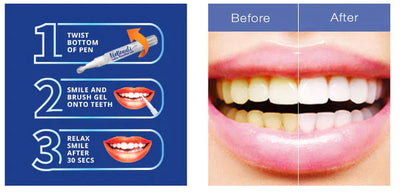 Teeth Whitening Pen